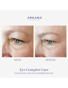 Formação Arkana - Eye Care Complex 2