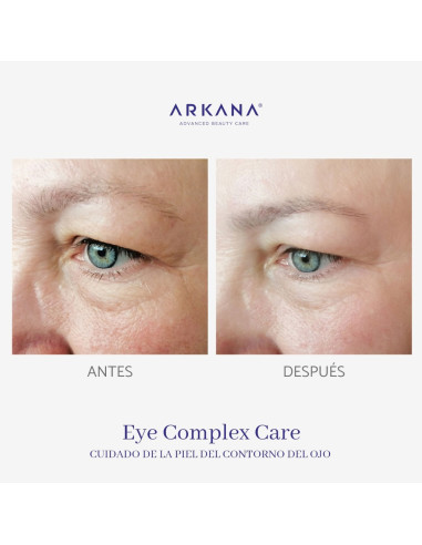 Formação Arkana - Eye Care Complex