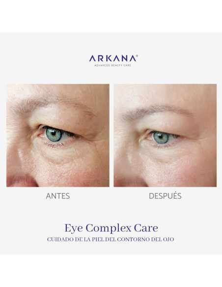 Formação Arkana - Eye Care Complex